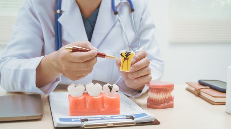 Dentist at Dental Nation in Las Vegas, NV explaining chipped or cracked tooth with a dental model.