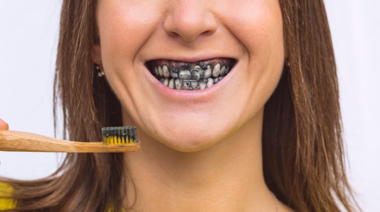 Woman brushing teeth with charcoal toothpaste, showing black-stained smile – Dental Nation, Las Vegas, NV.